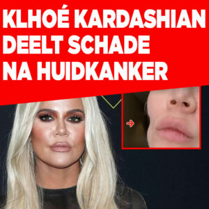 Khloé Kardashian deelt zichtbare schade in gezicht na huidkanker