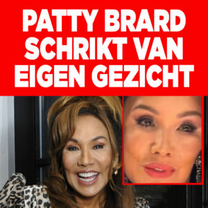 Patty Brard schrikt na zien eigen gezicht: &#8216;Zwelling is naar mijn ogen gezakt&#8217;