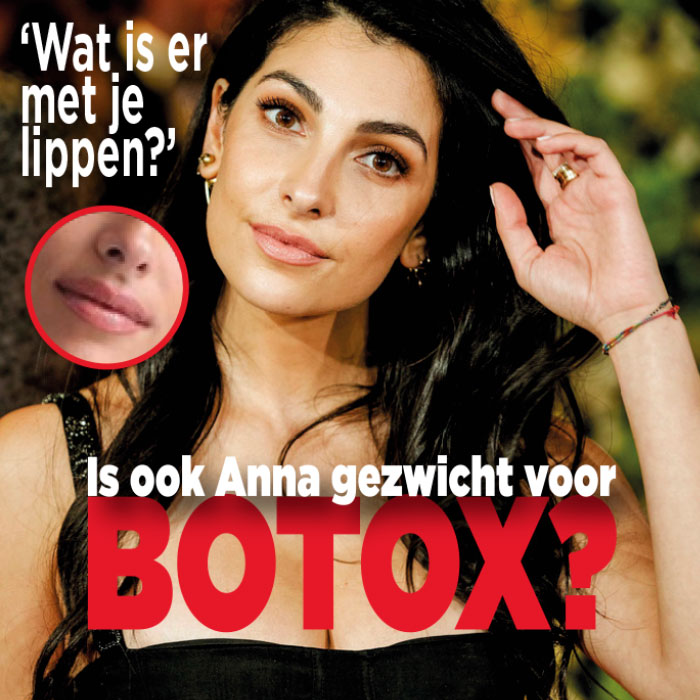 Ook Anna gezwicht voor botox en fillers?