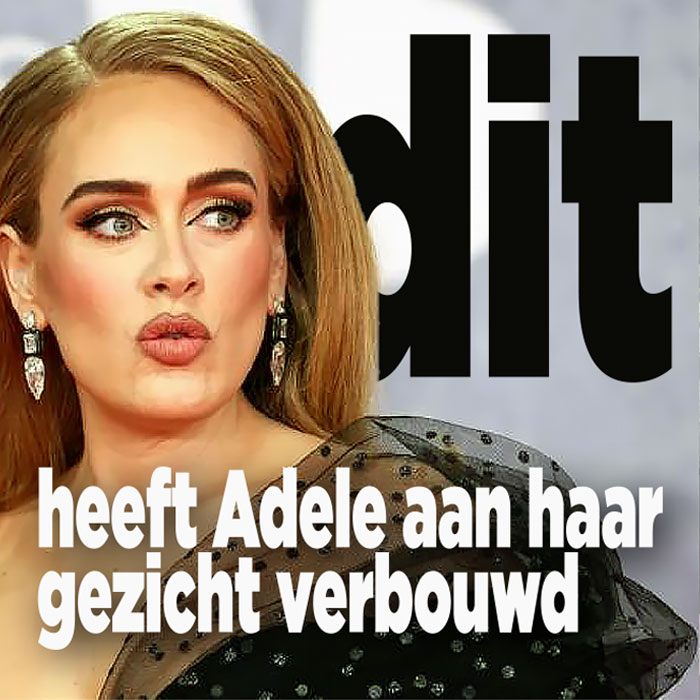Adele heeft nogal wat aan haar gezicht laten doen