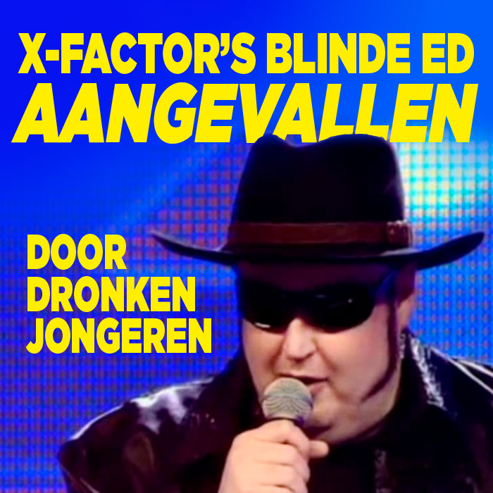 X Factor&#8217;s Blinde Ed aangevallen door dronken jongeren