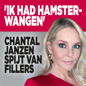 Chantal Janzen spijt van fillers: &#8216;Ik had hamsterwangen&#8217;