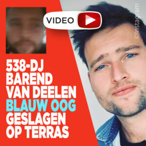 538-DJ Barend van Deelen blauw oog geslagen op terras