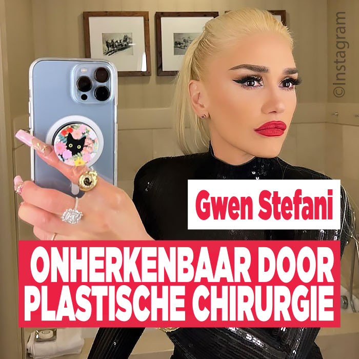Gwen Stefani onherkenbaar door plastische chirurgie