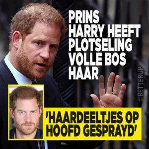 Prins Harry heeft plotseling volle bos haar: &#8216;Haardeeltjes op hoofd gesprayd&#8217;