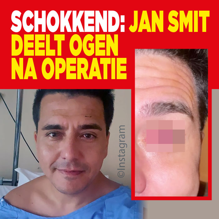 Schokkend: Jan Smit deelt ogen na operatie