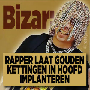 BIZAR: Rapper laat gouden kettingen in hoofd implanteren