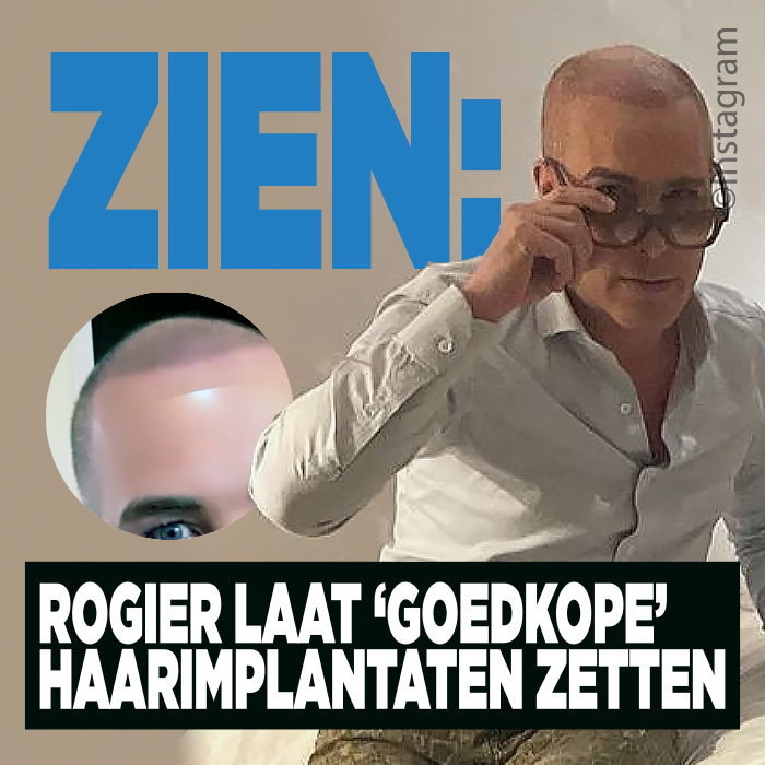 ZIEN: Rogier Smit ondergaat haartransplantatie &#8216;voor een prikkie&#8217;