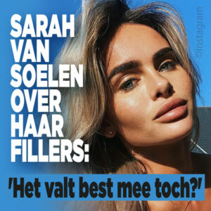 Sarah van Soelen over haar fillers: &#8216;Het valt best mee toch?&#8217;