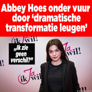 Abbey Hoes onder vuur door &#8216;dramatische transformatie leugen&#8217;