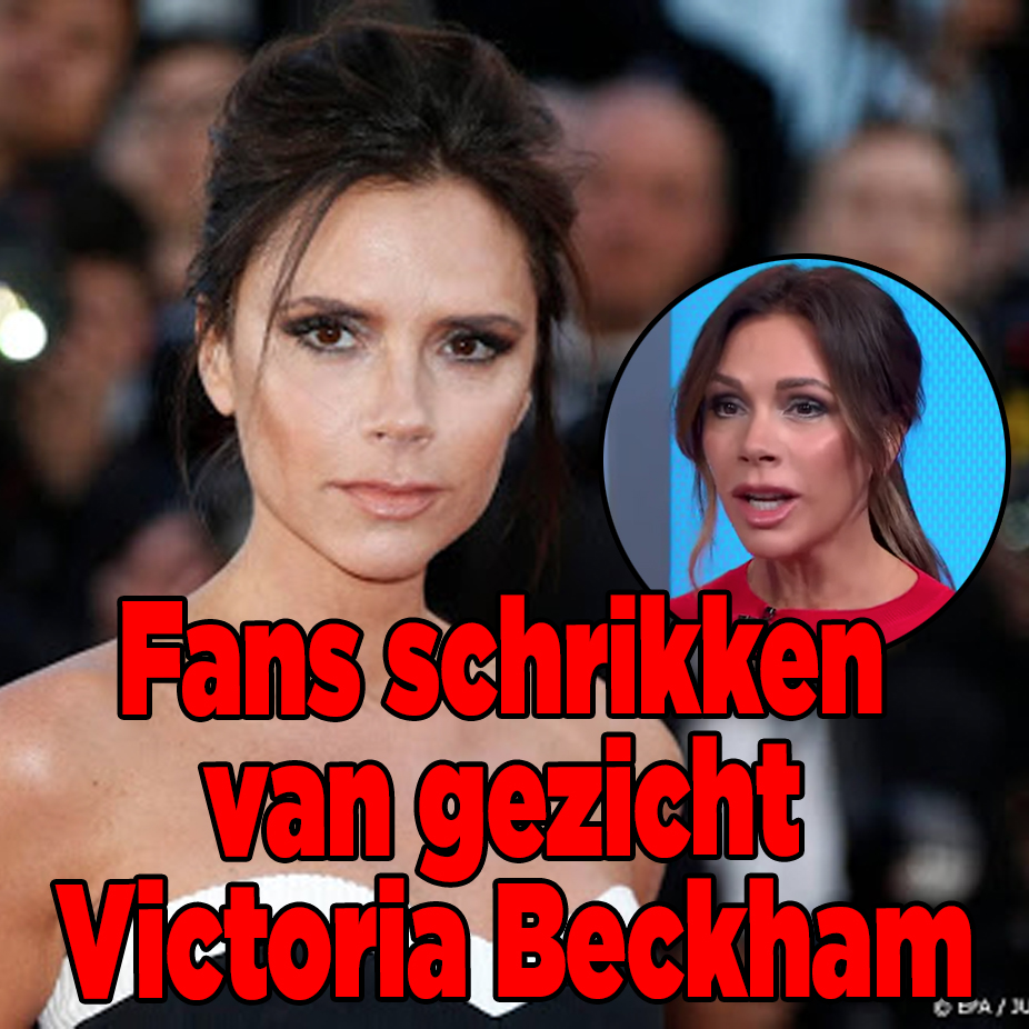 Fans schrikken van gezicht Victoria Beckham