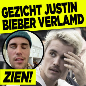 ZIEN: Gezicht Justin Bieber verlamd