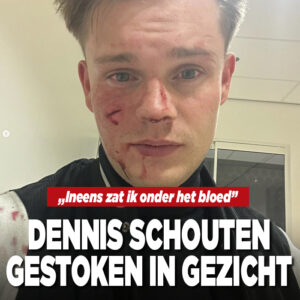 Dennis Schouten gestoken met mes in gezicht tijdens uitgaan