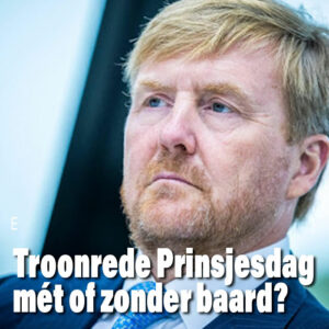 Willem-Alexander: wel of niet scheren vandaag