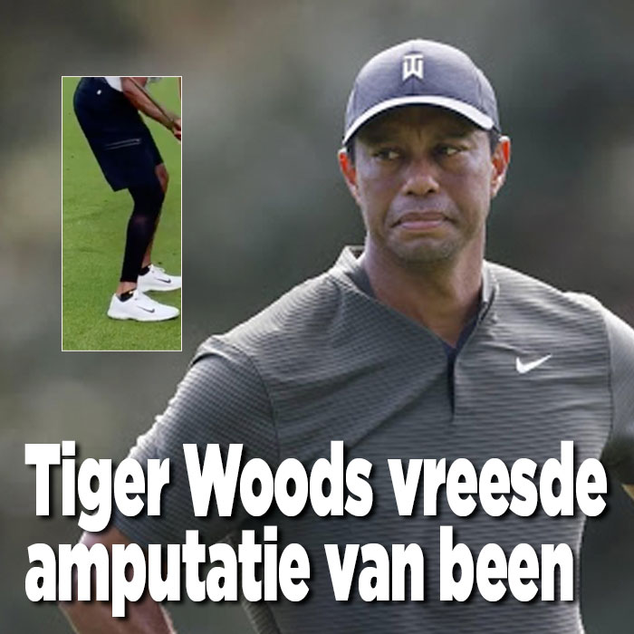 Amputatie rechterbeen Tiger Woods dreigde